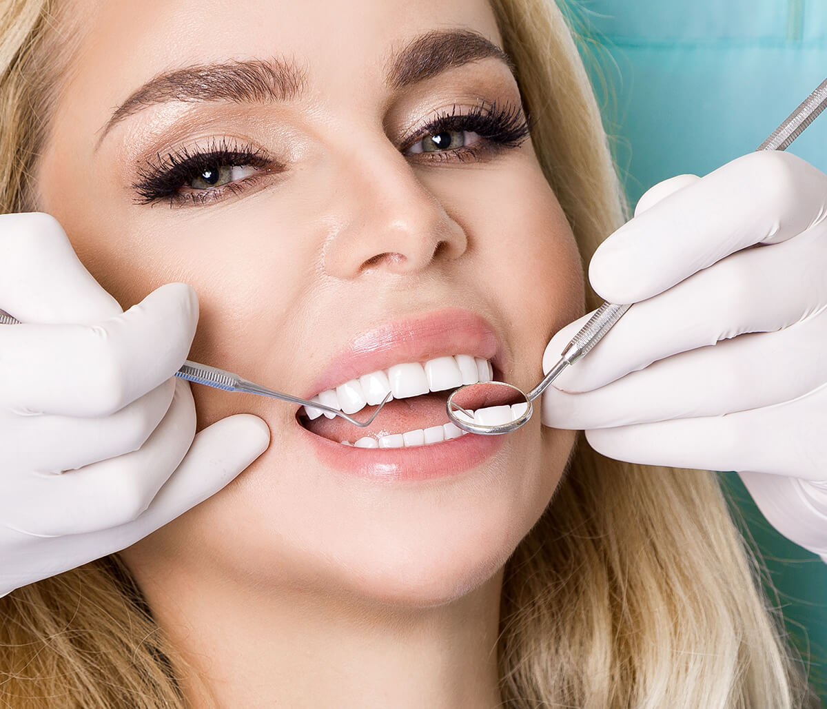 Healthy smiles flourish with white teeth filling treatment in Fort Worth, TX