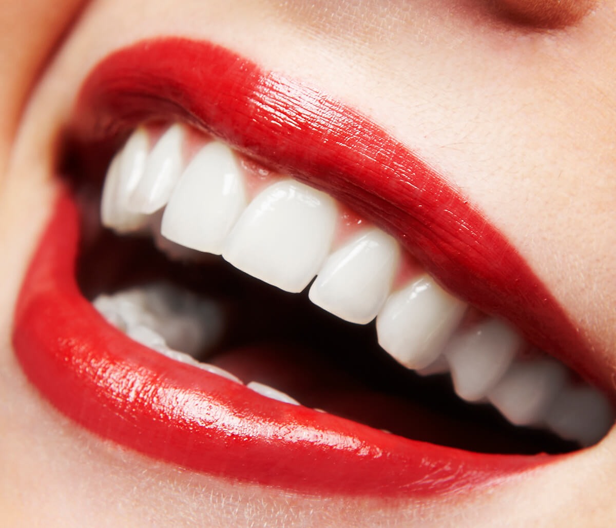 Cosmetic Treatments for Teeth: Small Steps in Fort Worth Area Make a Big Difference in Your Appearance, Confidence