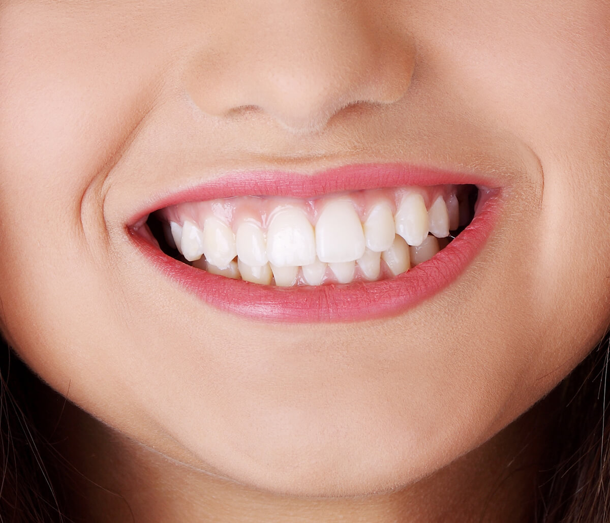 Professional Dental Whitening Treatment for Teeth Fort Worth TX Area