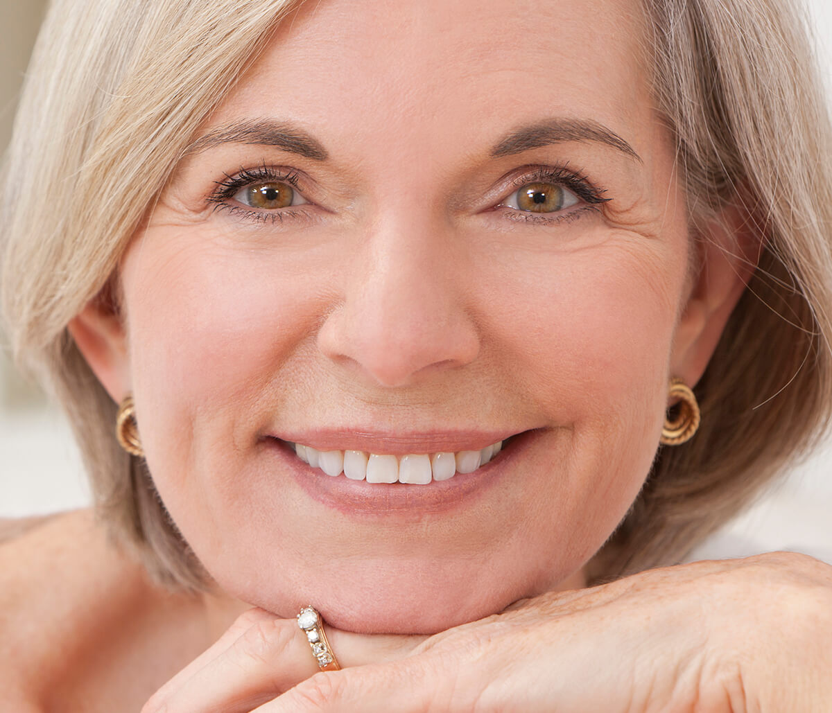 3 Signs Your Dentures Need Replacing with Quality Dentures